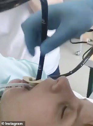 The snake was taken out of the woman's mouth while she was under general anaesthetic