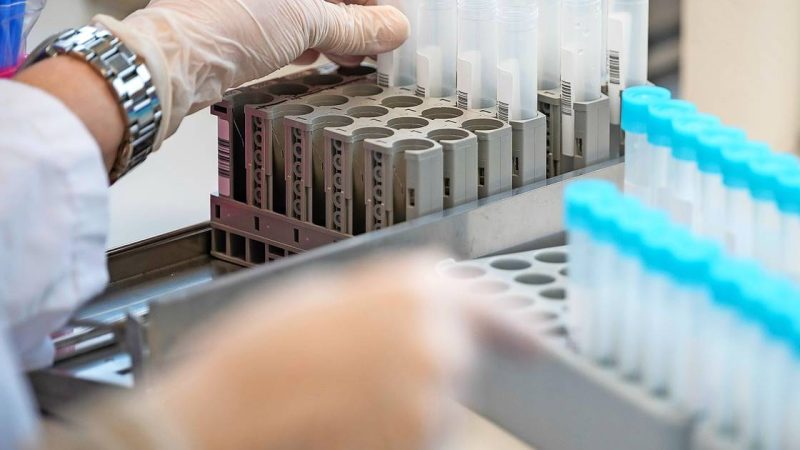 The Bioscienta Laboratory in St. Engbert conducts PCR tests for the Saarbrücken region

